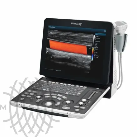 УЗИ аппарат Mindray Z60 Exp портативный