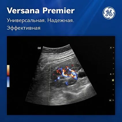 Клинические изображения Ультразвуковая система GE Versana Premier Black